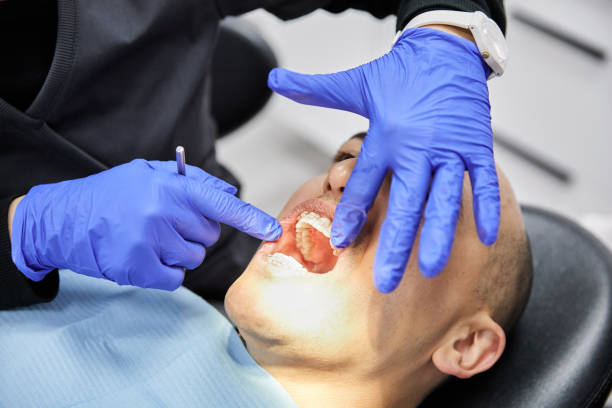 Best Emergency Treatment for Dental Infections or Abscesses in Rexburg, ID